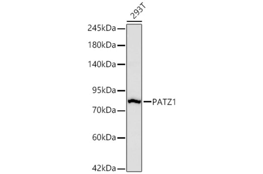 Western Blot - Anti-PATZ1 Antibody [ARC67668] (A329717) - Antibodies.com