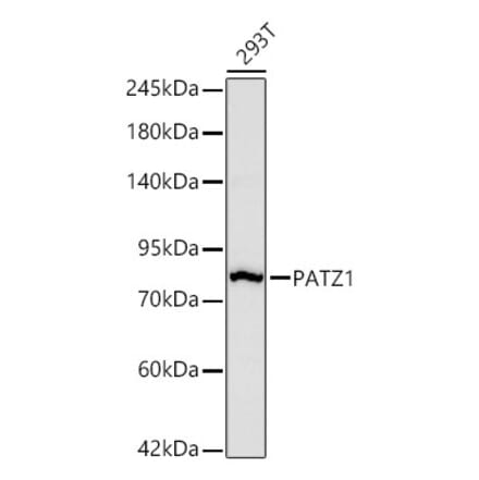 Western Blot - Anti-PATZ1 Antibody [ARC67668] (A329717) - Antibodies.com