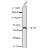 Western Blot - Anti-PATZ1 Antibody [ARC67668] (A329717) - Antibodies.com