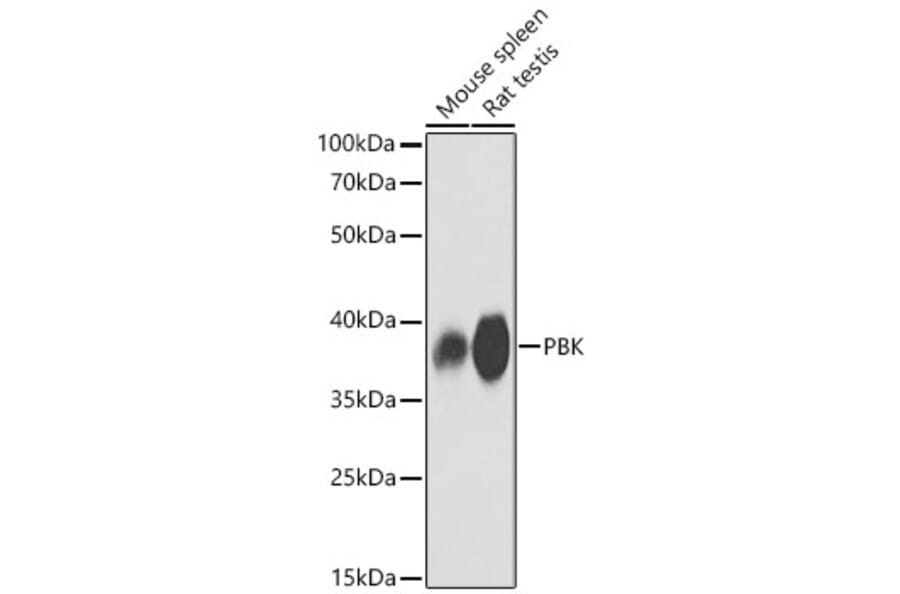 Western Blot - Anti-PBK Antibody (A329718) - Antibodies.com