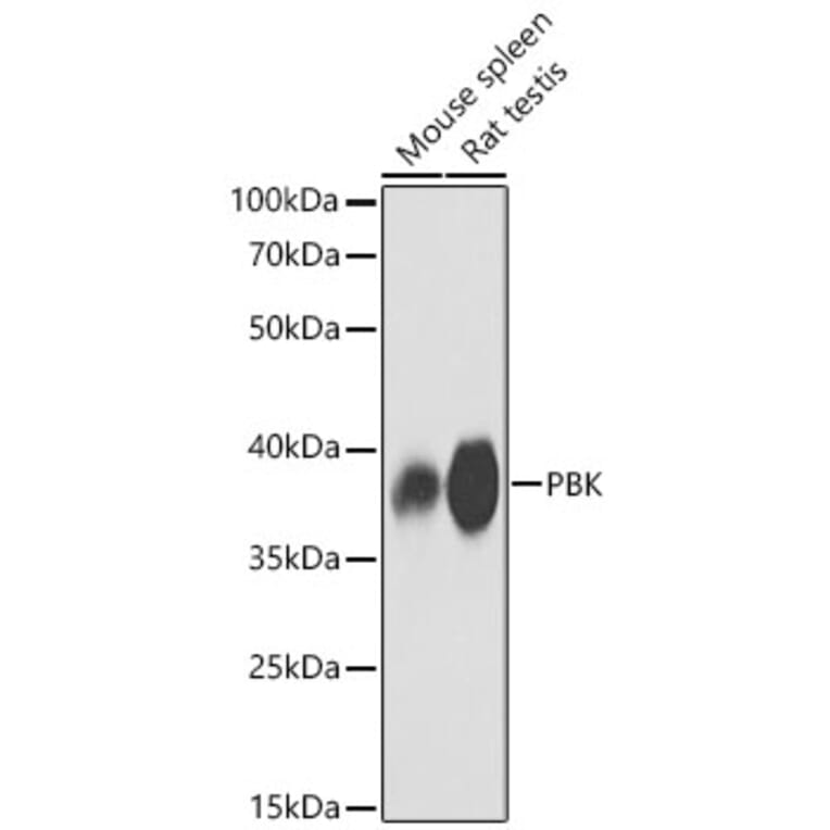 Western Blot - Anti-PBK Antibody (A329718) - Antibodies.com