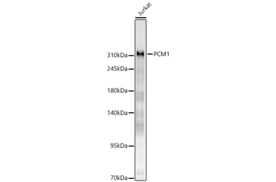 Western Blot - Anti-PCM1 Antibody (A329721) - Antibodies.com