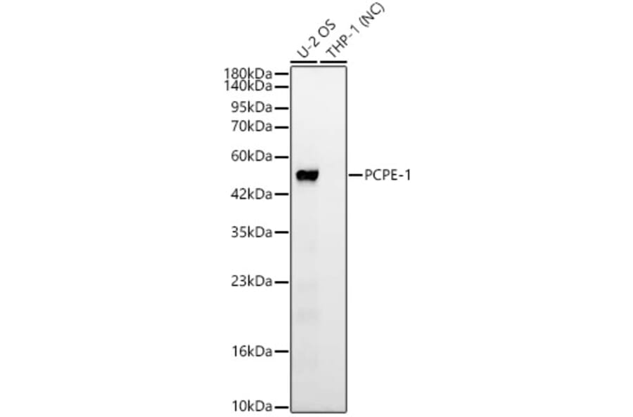Western Blot - Anti-PCOLCE Antibody [ARC63882] (A329722) - Antibodies.com