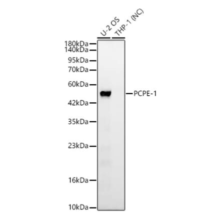 Western Blot - Anti-PCOLCE Antibody [ARC63882] (A329722) - Antibodies.com