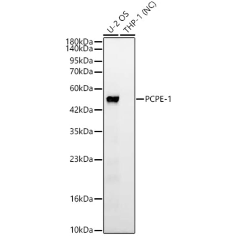 Western Blot - Anti-PCOLCE Antibody [ARC63882] (A329722) - Antibodies.com