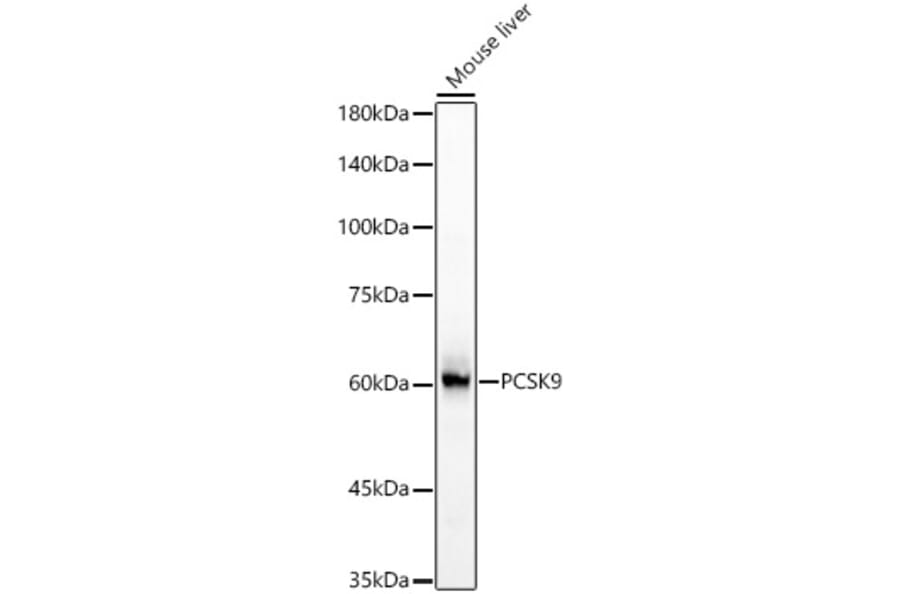 Western Blot - Anti-PCSK9 Antibody (A329723) - Antibodies.com