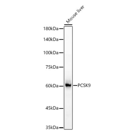 Western Blot - Anti-PCSK9 Antibody (A329723) - Antibodies.com