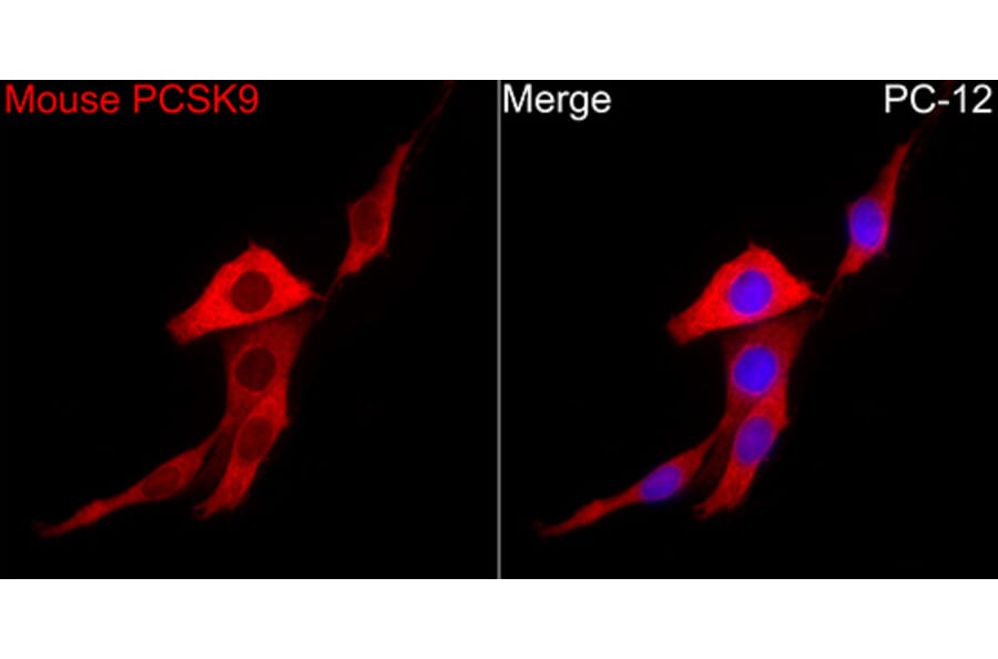 Immunofluorescence - Anti-PCSK9 Antibody (A329723) - Antibodies.com