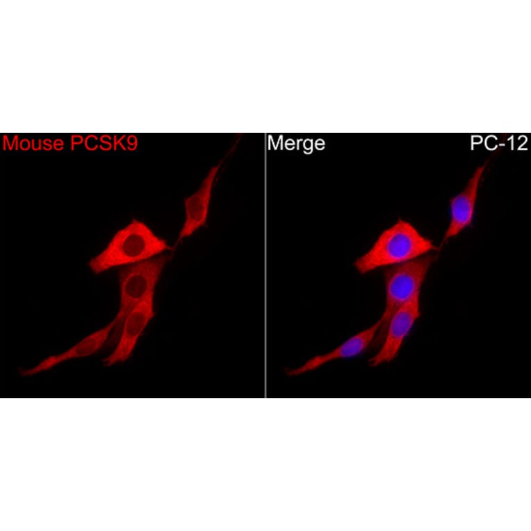 Immunofluorescence - Anti-PCSK9 Antibody (A329723) - Antibodies.com