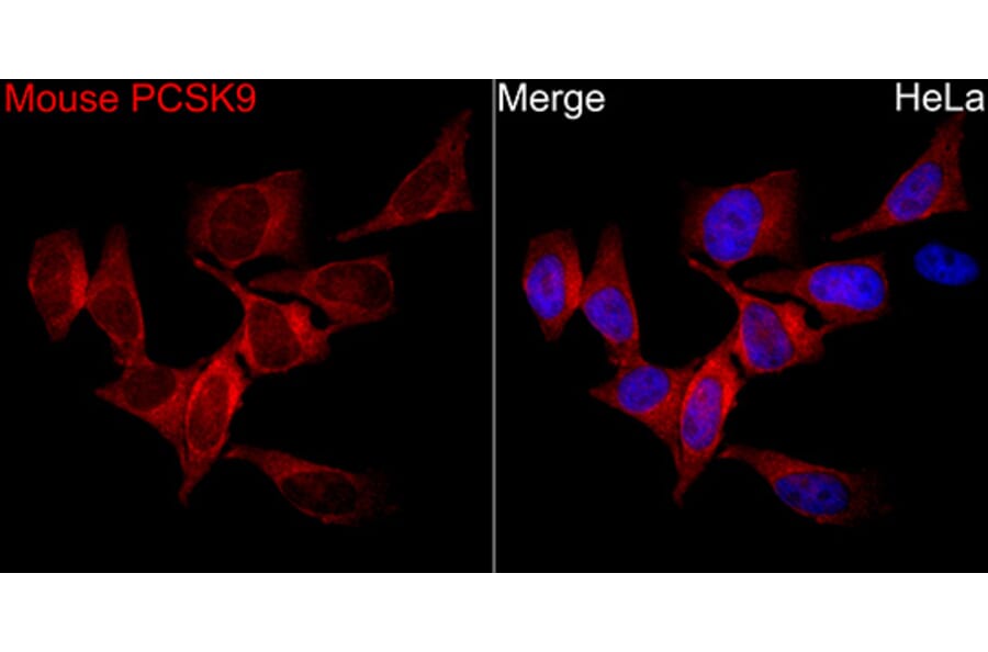 Immunofluorescence - Anti-PCSK9 Antibody (A329723) - Antibodies.com