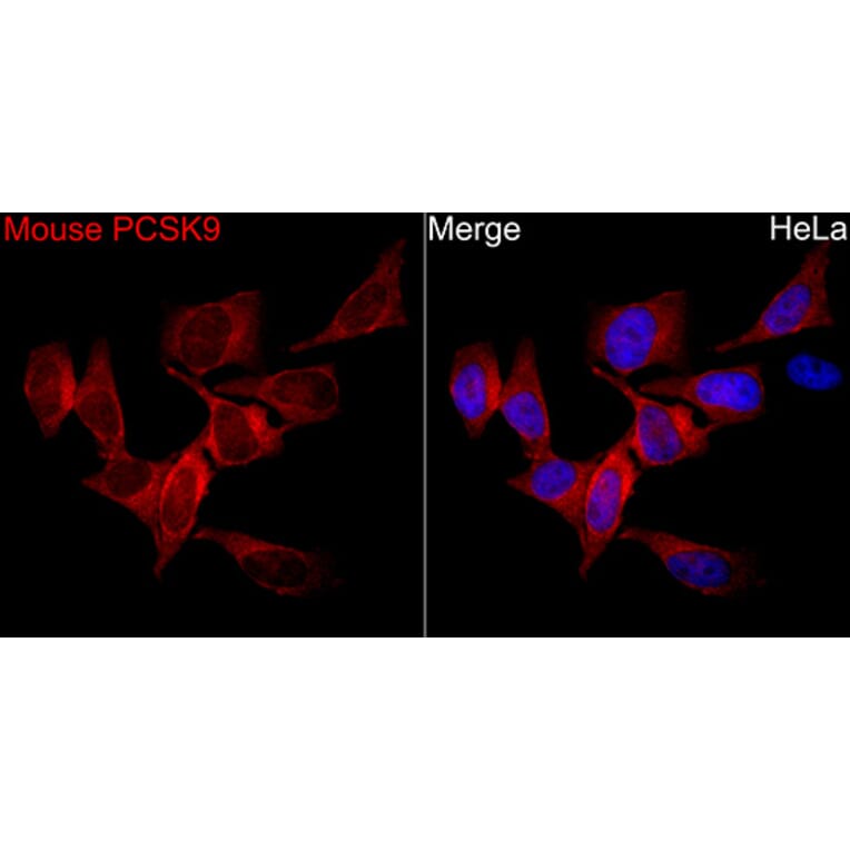 Immunofluorescence - Anti-PCSK9 Antibody (A329723) - Antibodies.com
