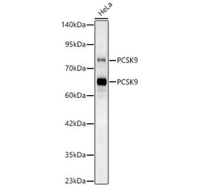 Western Blot - Anti-PCSK9 Antibody (A329724) - Antibodies.com