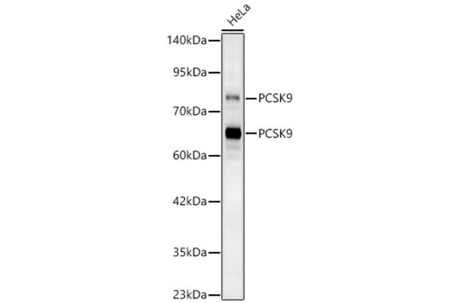 Western Blot - Anti-PCSK9 Antibody (A329724) - Antibodies.com