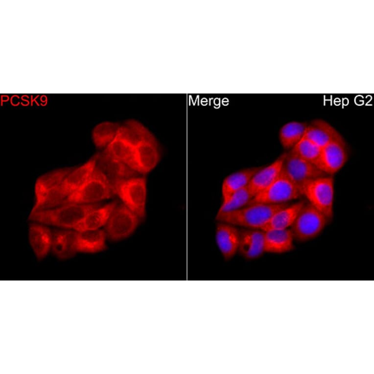 Immunofluorescence - Anti-PCSK9 Antibody (A329724) - Antibodies.com