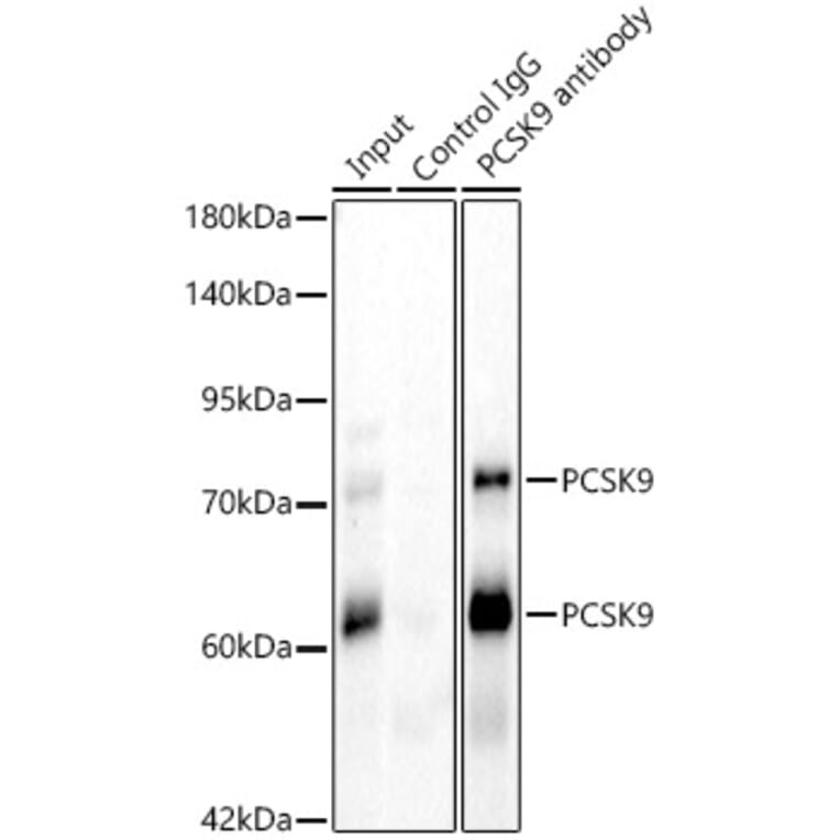 Immunoprecipitation - Anti-PCSK9 Antibody (A329724) - Antibodies.com