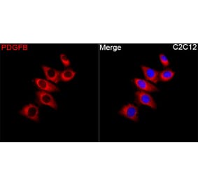 Immunofluorescence - Anti-PDGF B Antibody (A329725) - Antibodies.com