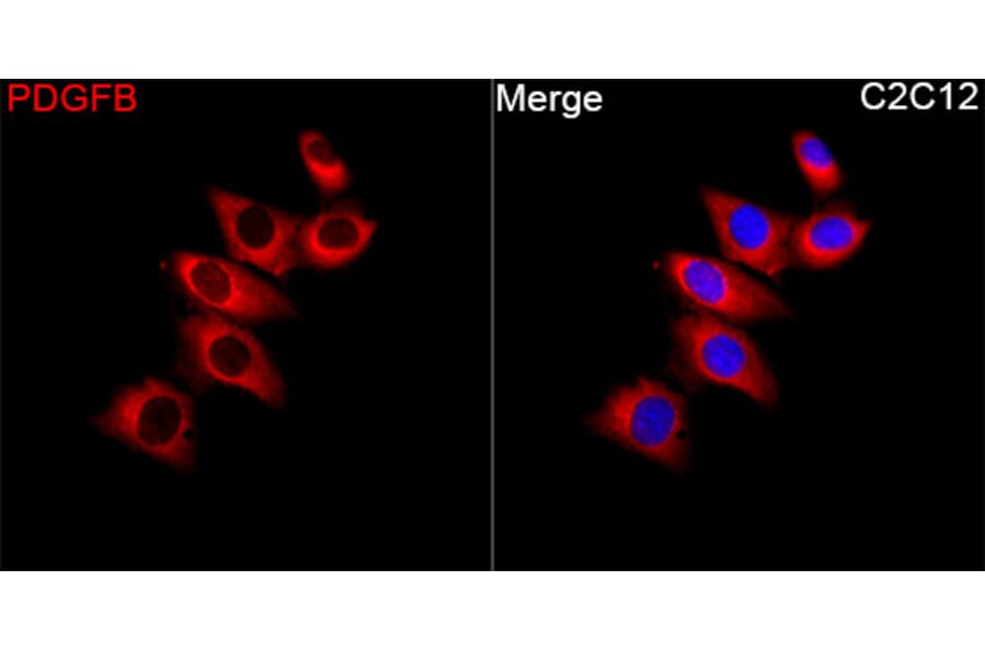 Immunofluorescence - Anti-PDGF B Antibody (A329725) - Antibodies.com