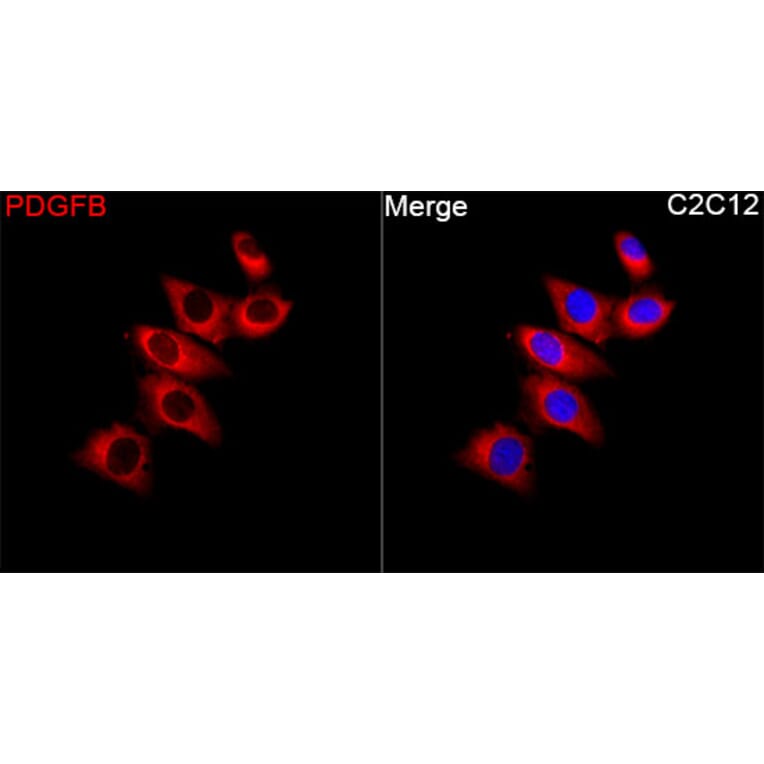 Immunofluorescence - Anti-PDGF B Antibody (A329725) - Antibodies.com