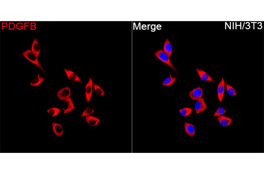 Anti-PDGF B Antibody (A329725) - Immunofluorescence