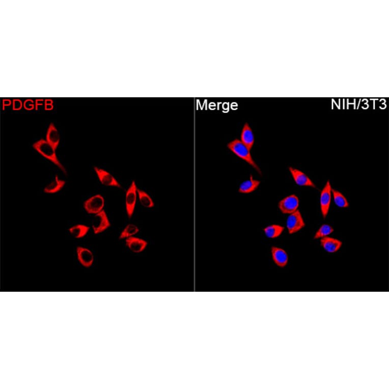 Immunofluorescence - Anti-PDGF B Antibody (A329725) - Antibodies.com