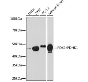 Western Blot - Anti-PDK1 Antibody [ARC1355] (A329726) - Antibodies.com