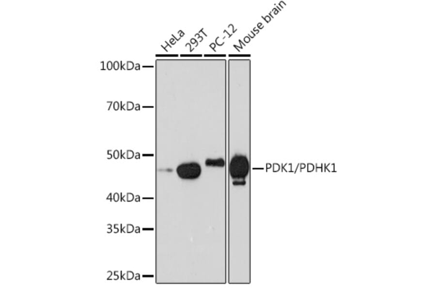 Western Blot - Anti-PDK1 Antibody [ARC1355] (A329726) - Antibodies.com