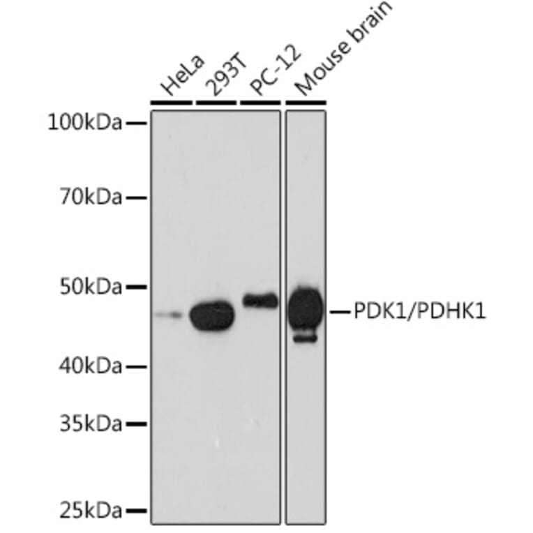 Western Blot - Anti-PDK1 Antibody [ARC1355] (A329726) - Antibodies.com