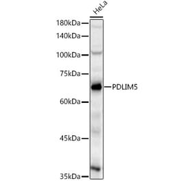 Western Blot - Anti-PDLIM5 Antibody (A329730) - Antibodies.com