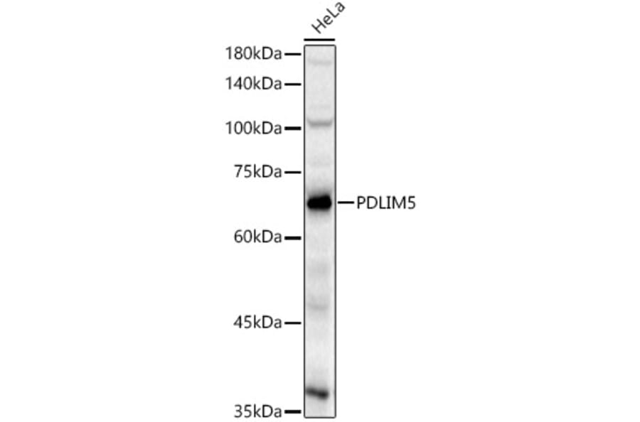 Western Blot - Anti-PDLIM5 Antibody (A329730) - Antibodies.com