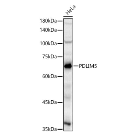 Western Blot - Anti-PDLIM5 Antibody (A329730) - Antibodies.com