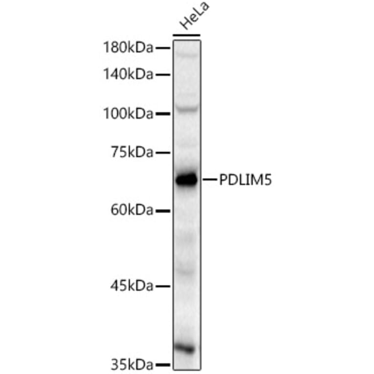 Western Blot - Anti-PDLIM5 Antibody (A329730) - Antibodies.com