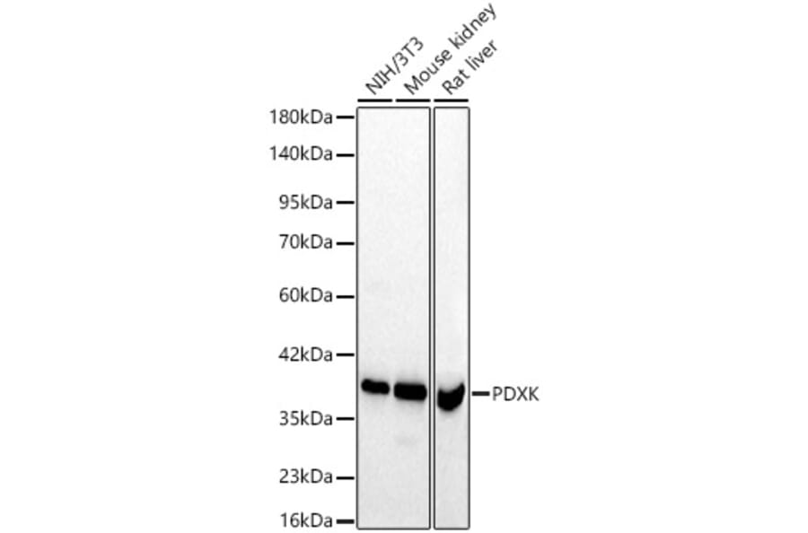 Western Blot - Anti-PDXK.1 Antibody (A329731) - Antibodies.com