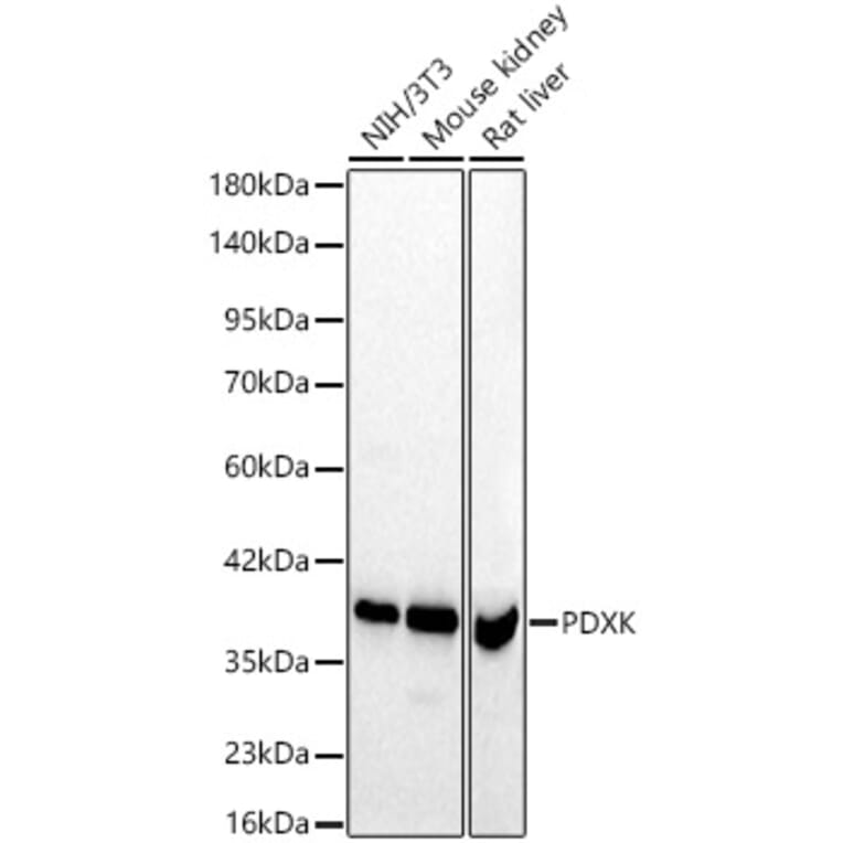 Western Blot - Anti-PDXK.1 Antibody (A329731) - Antibodies.com