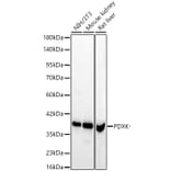 Western Blot - Anti-PDXK.1 Antibody (A329731) - Antibodies.com
