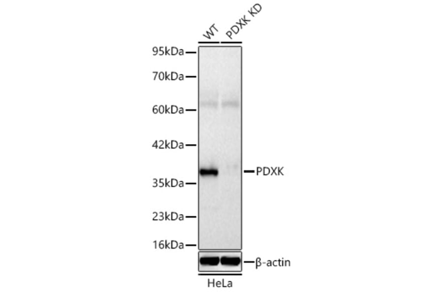 Western Blot - Anti-PDXK.1 Antibody (A329731) - Antibodies.com