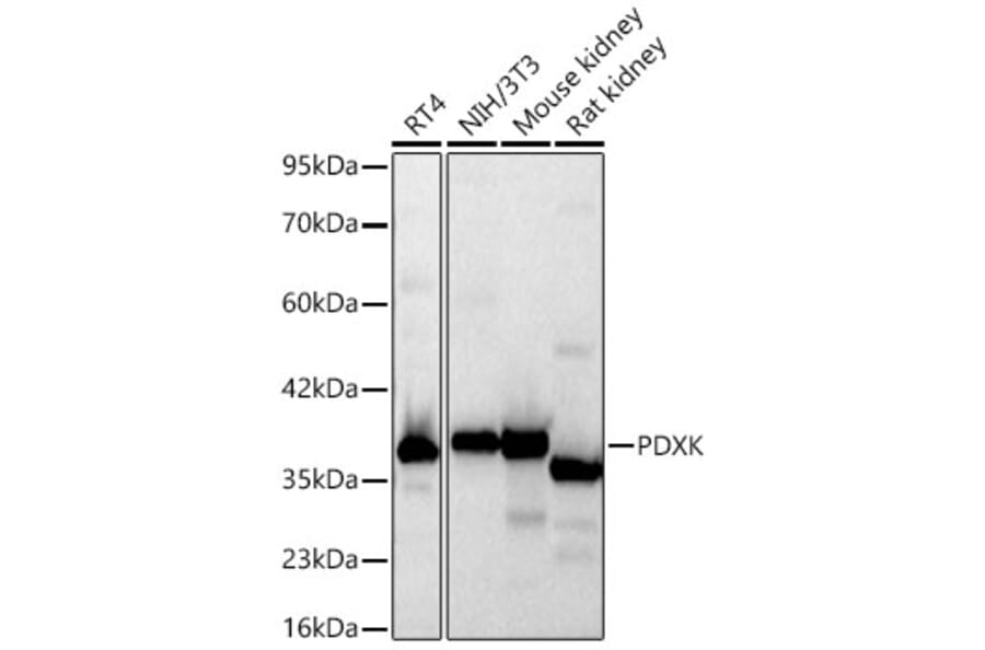 Western Blot - Anti-PDXK.1 Antibody (A329731) - Antibodies.com