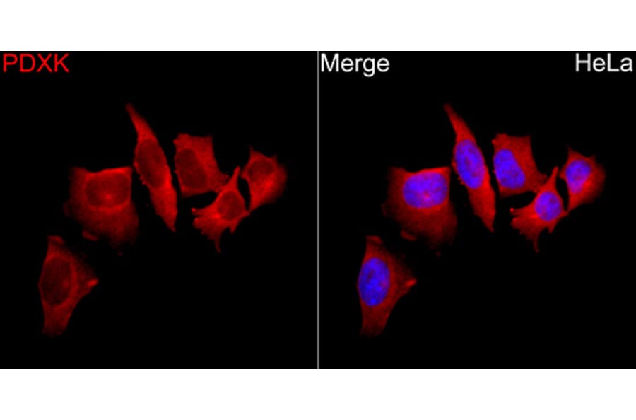 Immunofluorescence - Anti-PDXK.1 Antibody (A329731) - Antibodies.com