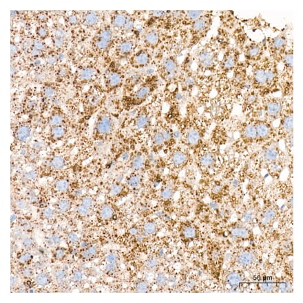 Immunohistochemistry - Anti-Perilipin 2 Antibody (A329732) - Antibodies.com