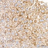 Immunohistochemistry - Anti-Perilipin 2 Antibody (A329732) - Antibodies.com