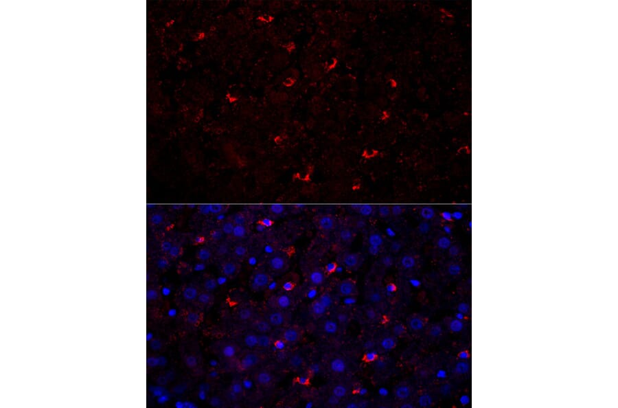 Immunofluorescence - Anti-Perilipin 2 Antibody (A329732) - Antibodies.com