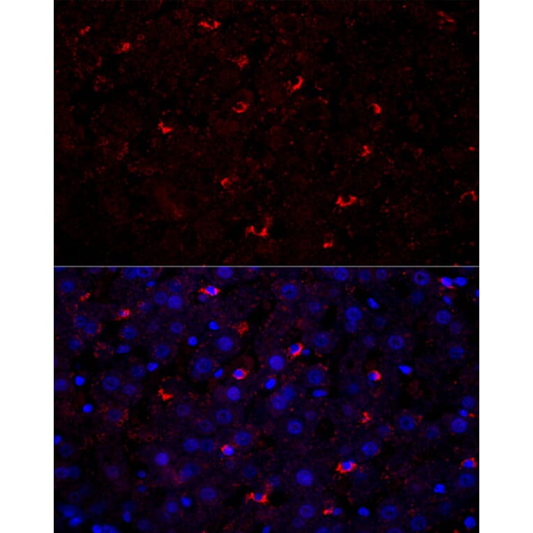 Immunofluorescence - Anti-Perilipin 2 Antibody (A329732) - Antibodies.com
