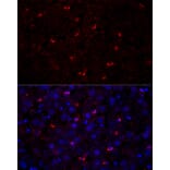 Immunofluorescence - Anti-Perilipin 2 Antibody (A329732) - Antibodies.com