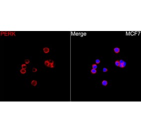 Immunofluorescence - Anti-PERK Antibody (A329733) - Antibodies.com