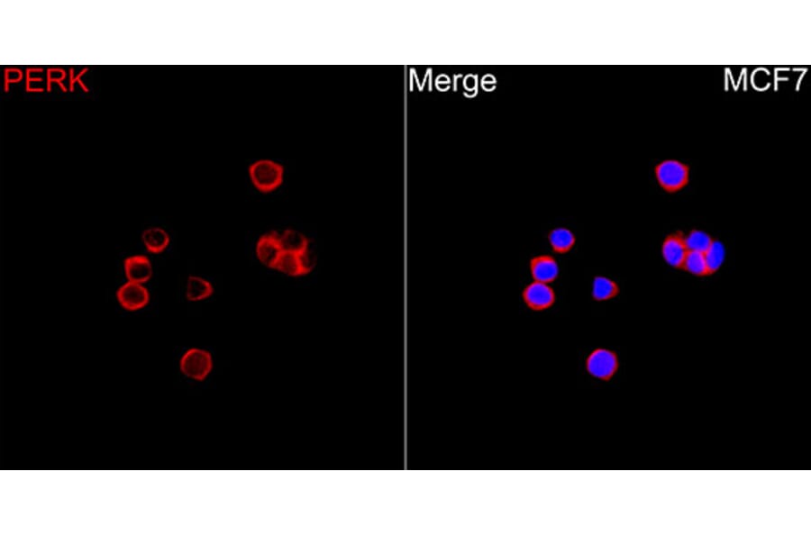 Immunofluorescence - Anti-PERK Antibody (A329733) - Antibodies.com