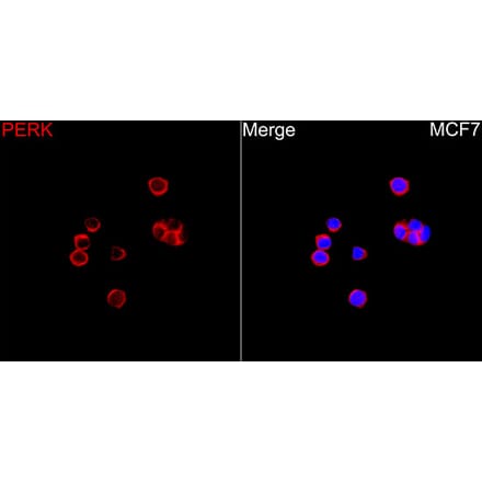 Immunofluorescence - Anti-PERK Antibody (A329733) - Antibodies.com