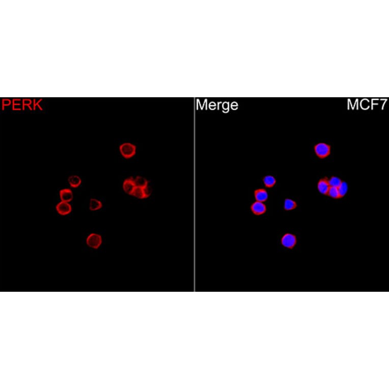 Immunofluorescence - Anti-PERK Antibody (A329733) - Antibodies.com