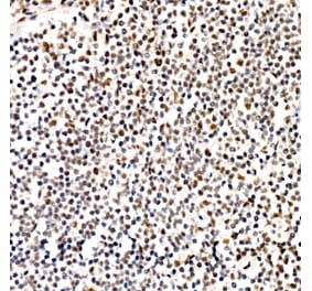 Immunohistochemistry - Anti-PERK (Phospho T982) Antibody [ARC58933] (A329734) - Antibodies.com