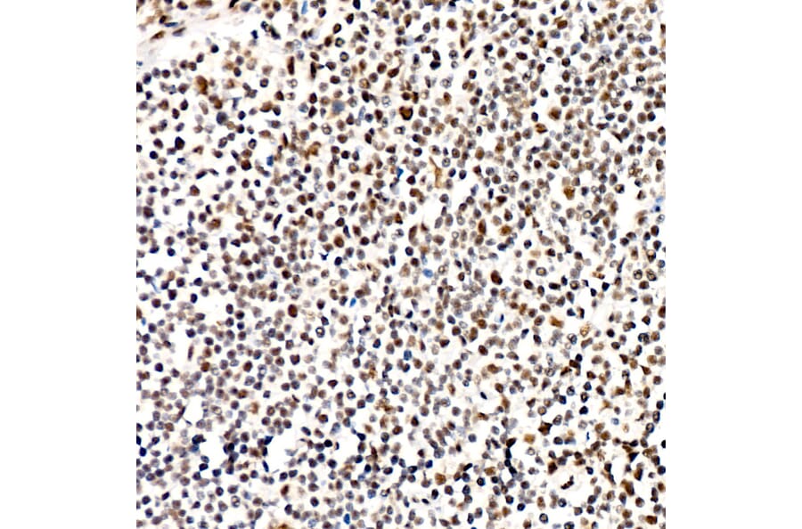 Immunohistochemistry - Anti-PERK (Phospho T982) Antibody [ARC58933] (A329734) - Antibodies.com