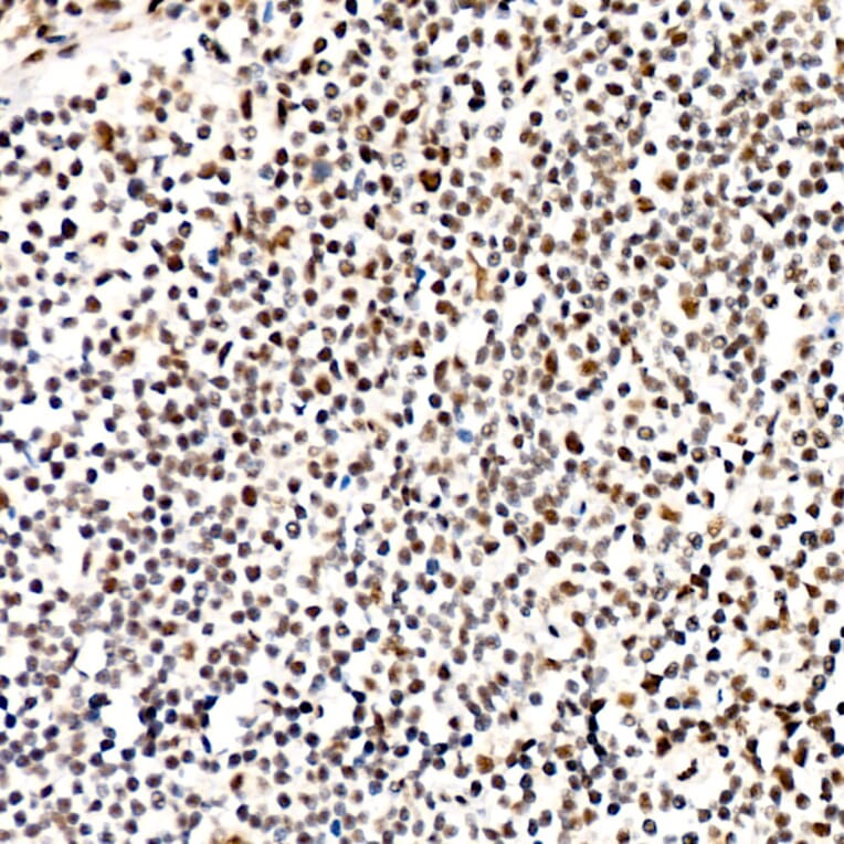 Immunohistochemistry - Anti-PERK (Phospho T982) Antibody [ARC58933] (A329734) - Antibodies.com
