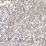 Immunohistochemistry - Anti-PERK (Phospho T982) Antibody [ARC58933] (A329734) - Antibodies.com